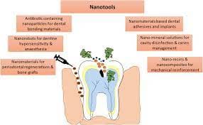 dental nanotehnologija